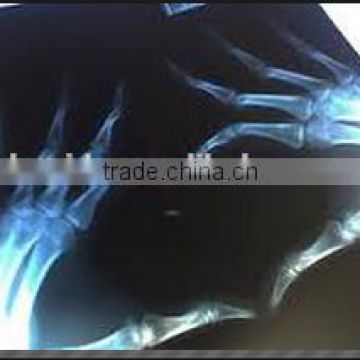 konida medical film from china for hospital film konica film blue film