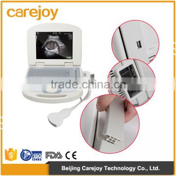 Factory price comfortable application and professional software package portable ultrasound machine for pregnancy