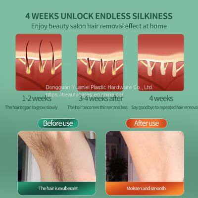 High Quality Portable Depilador Face Body Best Permanent Cheapest Ipl Laser Hair Removal Machine photo-4