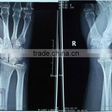 kodak x-ray filmx-ray film thermal dry film china hot film china classic hot film