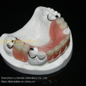 Dental Partial Acrylic Denture, Complete Denture, Full Dental Dentures, Laboratoire Dentaire, Dentallabor, Laboratorio Dental, Dental Laboratory, Shenzhen LJ Dental Lab China photo-4