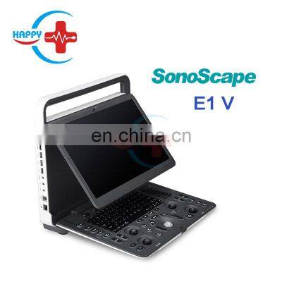 Factory price  ultrasound device Price / New Released Sonoscape Vet Ultrasound E1V