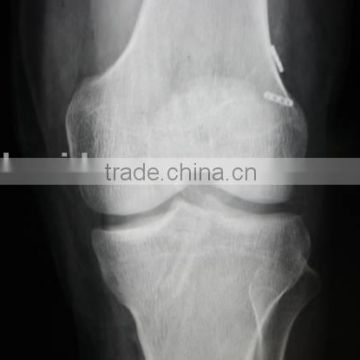 medical thermal x ray film,medical equipment dealer ,a4 lamination film