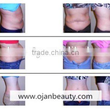 2016 Portable Lipo Laser Machine With Factory Price photo-5