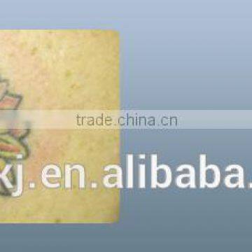 Fda Approval Nd:yag Laser Hair Removal Device/tattoo for Removal photo-2