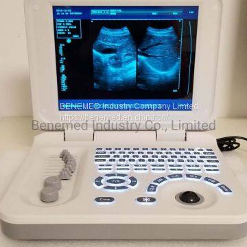 Ноутбук-тип черно-белый ультразвуковой сканер диагностического оборудования photo-3