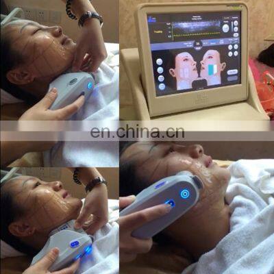 Portable Mini Hifu Lifting Machine Home Use Hifu 2022 Mini Hifu Machine Facial New Product Face Lift Ultrasound Lipo