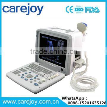 high performance low price ultrasound machine