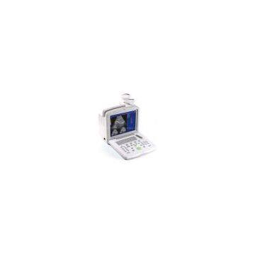 Portable Convex Ultrasound Scanner---CE Certified photo-3