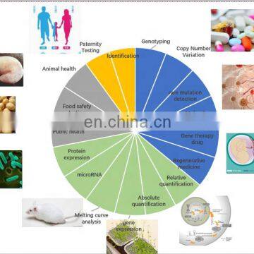Realtime Quantitative PCR Detection System Lab Qpcr Machine photo-3