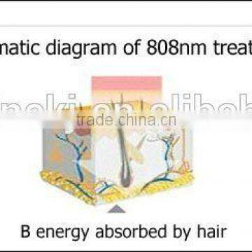 Hot Selling 10 Laser Bars TEC Condenser 808nm Permanent Hair Removal Laser Depilator Home photo-3