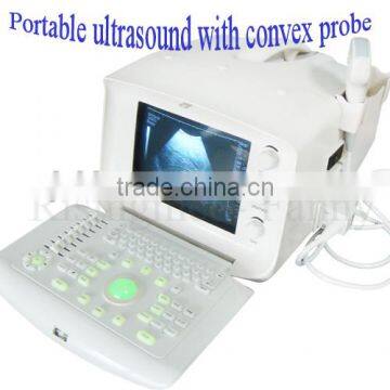 Promotion!!CE Approved Notebook USB Ultrasound Scanner With 3.5Mhz Multi-frequency Convex Probe RUS-6000A photo-3