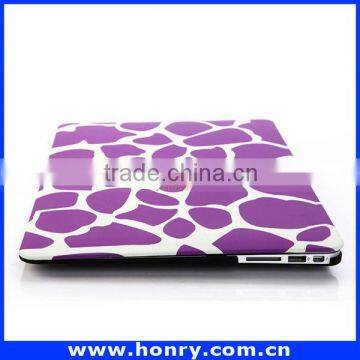 New OEM Special Ultra Thin pc Case for Macbook photo-6