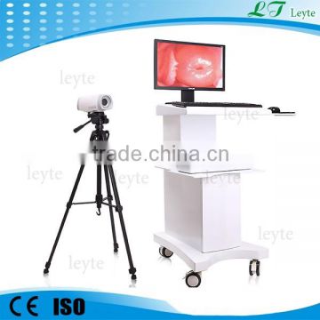 2015 hot sale LT9802 video colposcope for vagina