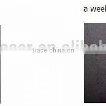 YUWEI Portable Medical Face Lift Scar Removal Machine With Micro Needle RF photo-5