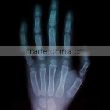 Medical digital x-ray film/DR x ray film/CT X ray film