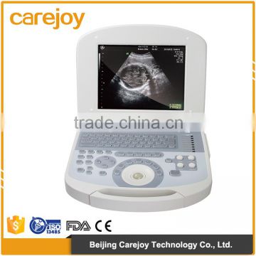 CE approved Health & Medical equipment 256 Image scale portable laptop ultrasound machine