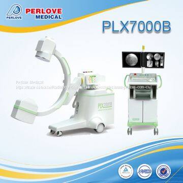 Worldwide installation C arm equipment PLX7000B for peripheral angiography