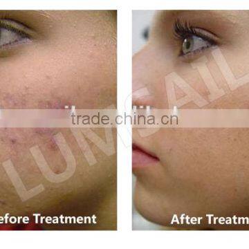 Laser Treatment Unit Photon BIO LED Light Therapy Machine PDT Red+ Blue +Infrared Light Therapy photo-5