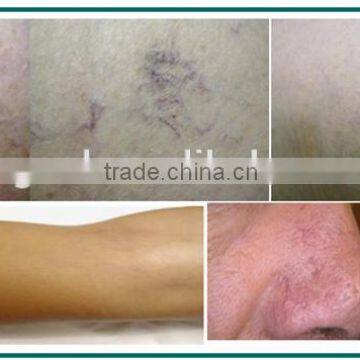 2015 China Newest Technology Diode Laser 980nm Machine / Laser Vascular Vein Removal / 980nml Aser Vein Removal Machine for Sale photo-6