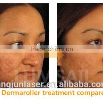 Zgts Derma Roller / Biogenesis Dns Derma Roller photo-6