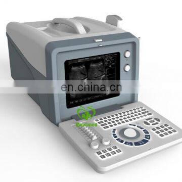 MY-A001A Laptop Full Digital Portable Ultrasound Scanner Mini Ultrasound Machine photo-4
