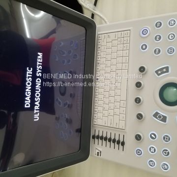 Ultraslim Notebook Type Black and White Ultrasound Scanner Equipment