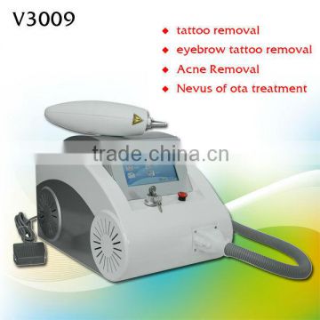 2013 Professional Tattoo Removal Skin Rejuvenation Equipment