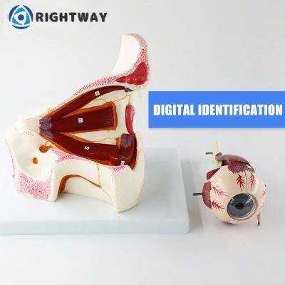 Офтальмологическая клиника. Демонстрация состояния роговицы глаза. Инструмент для демонстрации глаукомы человеческого глаза photo-4