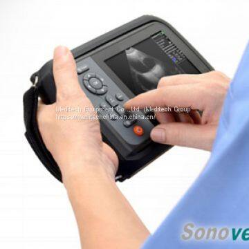 Sonovet-ID Veterinary Ultrasound Scanner With RFID Technology photo-2