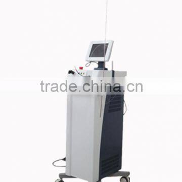 1064nm 50Hz Nd yag laser nail fungus laser with Intelligent alarm system