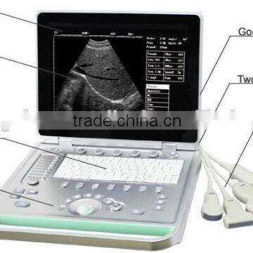 MCB-SS-7 15in Portable B Ultrasound Scanner