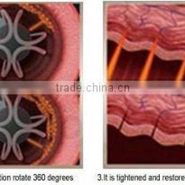 High Quality!!! Vaginal Tighten Hifu Equipment /vaginal Rejuvenation Hifu photo-5