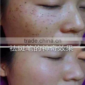 2016 New Freckle Spot Mole Removel Laser Pen Beauty Skin Laser Pen
