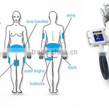 CE / FDA approved 3 cryo handles cryotherapy body slimming fat freezing laser