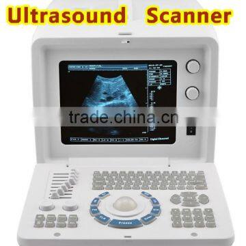 Good image Ultrasound Machine with linear transvaginal convex microconvex rectal probe