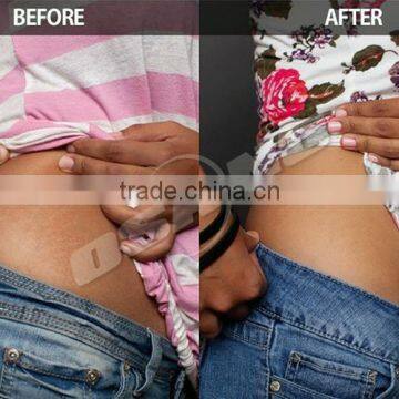 Body Slimming Supplier Of Cryolipolysis Beauty Device 3d Lipo Machine For Sale Zeltiq photo-6