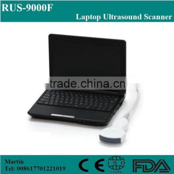 Portable Laptop ultrasound scanner with CE