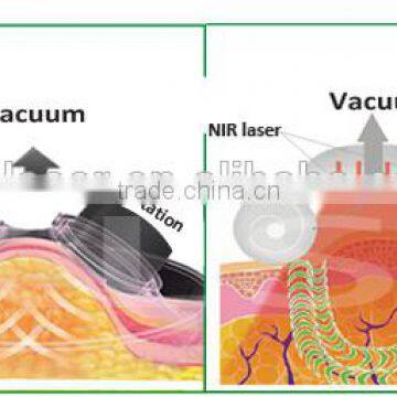 Cellulite Reduction Fat Loss Body 100J Slimming Machine/Vacuum Cavitation RF Ultrasonic Slimming Ultrasonic Weight Loss Machine photo-4