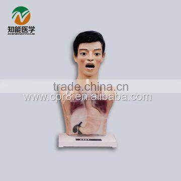 Transparent Gastric Lavage Model