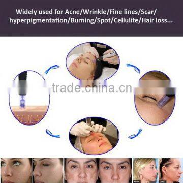 Microneedle Derma Pen /electric Derma Pen / Auto Derma Pen photo-6
