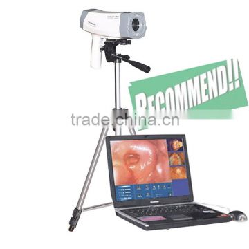 Highly recommend Electronic Colposcope with CCD Sony Camera 800,000 pixels with Analysis software RCS-400 model