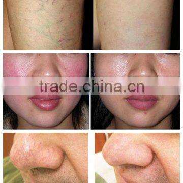 980nm Laser Spider Vein Stopper Laser Vascular Burner / Laser Vascular Burner photo-5