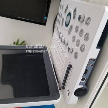 Ultraslim Notebook Type Black and White Ultrasound Scanner Machine Bw-8 photo-2