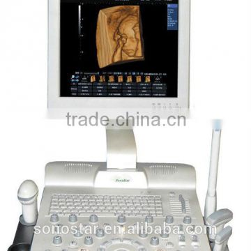 ultrasound scanner