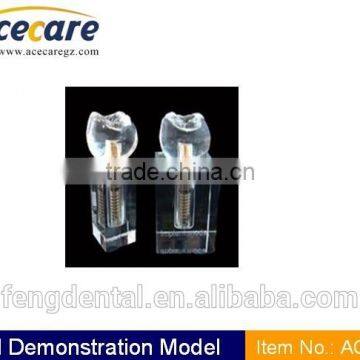 dental supply Crystal implant model I, II AC-P16