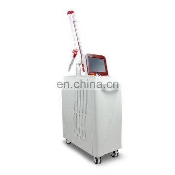 qs nd-yag laser tattoo removal machine nd yag laser