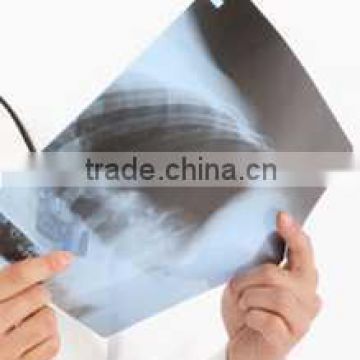 Good price china medical dry film