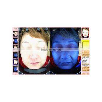 CE / ISO Approval Skin Scanner Analyzer Magic Analyzer Ostar Beauty SA 03 photo-2