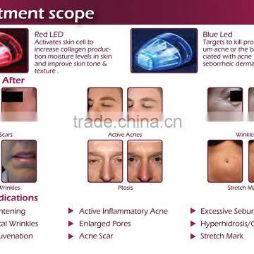 Easy to Delegates Microneedle Fractional rf Machine Radio Frequency Facial photo-5